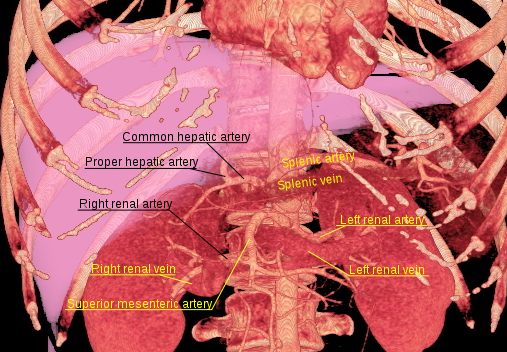 File:3D rendered CT of abdominal aortic branches and kidneys.svg